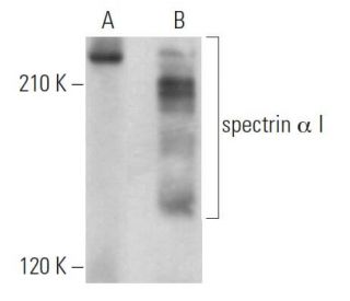 spectrin &alpha; I Antibody (B-12) - Western Blotting - Image 362966 