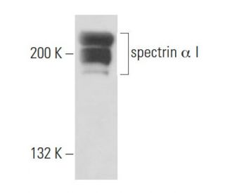 spectrin &alpha; I Antibody (IID2) - Western Blotting - Image 15550