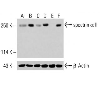 spectrin &alpha; II Antibody (B-2) - Western Blotting - Image 414850Each CRISPR/Cas9 Knockout (KO) Plasmid product consists of a pool of 3 plasmids designed to ensure identification and cleavage of a specific gene for maximum knockout efficiency. Each plasmid encodes a unique 20 nt sequence derived from the GeCKO (v2) library. 