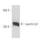 spectrin β I Antibody (4C3) - Western Blotting - Image 15578