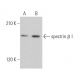 spectrin β I Antibody (A-12) - Western Blotting - Image 365489