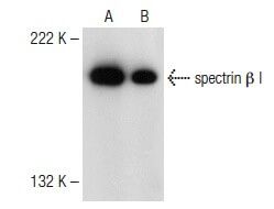 spectrin β I抗体 (B-1) | SCBT - Santa Cruz Biotechnology