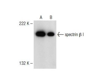 spectrin β I 항체 (C-18) | SCBT - Santa Cruz Biotechnology