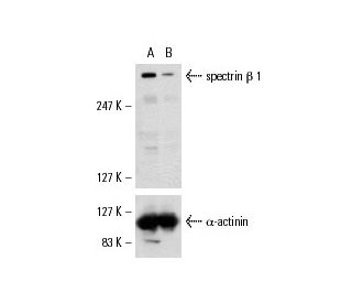 spectrin &beta; I siRNA (h): sc-36547. Western blot analysis of spectrin &beta; I expression in non-transfected control (A 