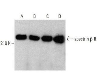 western blotting image from recommended spectrin &beta; II (F-7) monoclonal antibody replacement. Image 352610