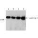 western blotting image from recommended spectrin β II (F-7) monoclonal antibody replacement. Image 352610