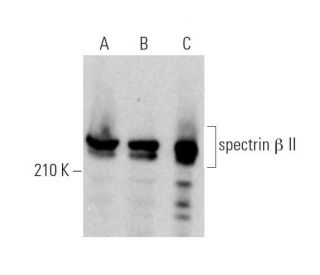 spectrin &beta; II Antibody (F-11) - Western Blotting - Image 373380 