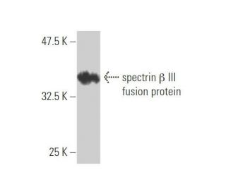 spectrin &beta; III Antibody (4D9) - Western Blotting - Image 348853