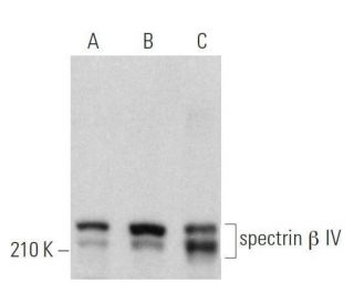 spectrin &beta; IV Antibody (F-5) - Western Blotting - Image 358996 