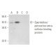 Spermidine/putrescine extracellular binding protein Antibody (E-1) - Western Blotting - Image 309484