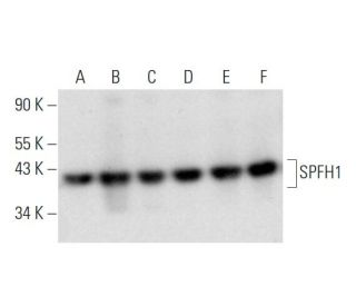 SPFH1 Antibody (A-7) - Western Blotting - Image 332820 