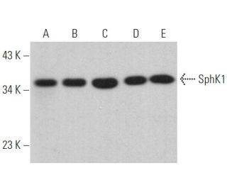 SphK1 Antibody (G-11) - Western Blotting - Image 362206 