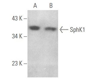 SphK1 Antibody (M-209): sc-48825