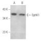 このポリクローナル抗体は販売終了となりました。弊社推奨の<a href="sphk1-antibody-g-11">SphK1 (G-11)</a>モノクローナル抗体をご覧ください(サンプルデータを表示)。 western blotting image from recommended SphK1 (G-11) monoclonal antibody replacement. Image 354569