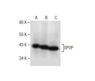 SPOP Antibody (B-8) - Western Blotting - Image 282531SAM Transcription Activation: SAM system utilizing dCas9-VP64, MS2-P65-HSF1, and sgRNA for precise gene transcription activation.