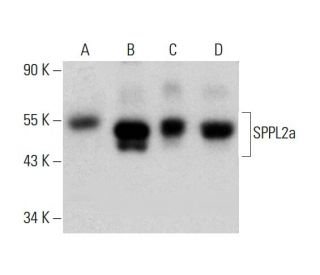 SPPL2a Antibody (1C7) - Western Blotting - Image 384253 