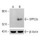 SPPL2a Antibody (1C7) - Western Blotting - Image 414186 