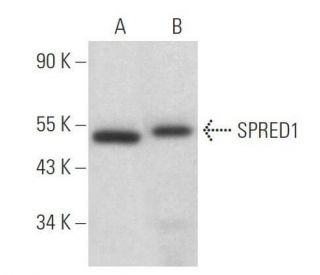 SPRED1 Antibody (E-5) - Western Blotting - Image 358961