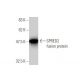 SPRED2 Antibody (6G8) - Western Blotting - Image 350351
