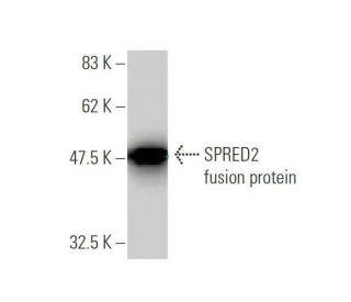 SPRED2 Antibody (6G8) - Western Blotting - Image 350351Each CRISPR/Cas9 Knockout (KO) Plasmid product consists of a pool of 3 plasmids designed to ensure identification and cleavage of a specific gene for maximum knockout efficiency. Each plasmid encodes a unique 20 nt sequence derived from the GeCKO (v2) library.
