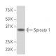 Sprouty 1 Antibody (RR-15) - Western Blotting - Image 34233 