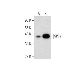 SPSY Antibody (A-4) - Western Blotting - Image 155058 