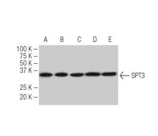 SPT3 Antibody (71-S) - Western Blotting - Image 67385 