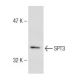 SPT3 Antibody (71-S) - Western Blotting - Image 147197