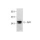 Spt3 Antibody (D-11) - Western Blotting - Image 287833