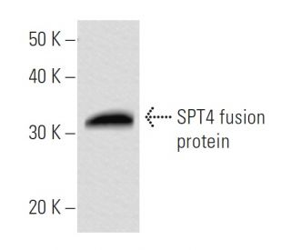 SPT4 Antibody (3079C1a) - Western Blotting - Image 16777
