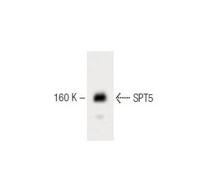 SPT5 Antibody (17) - Western Blotting - Image 60444 