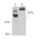 SPT5 Antibody (D-10) - Western Blotting - Image 363158