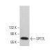 SPT7L Antibody (F-5) - Western Blotting - Image 379060