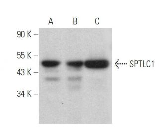 SPTLC1 Antibody (H-1) - Western Blotting - Image 359320 