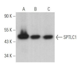 SPTLC1 Antibody (H-1) - Western Blotting - Image 364284