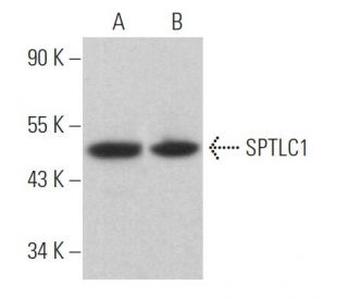 SPTLC1 Antibody (H-1) - Western Blotting - Image 364201
