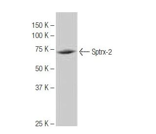Sptrx-2 Antibody (KK-M5) - Western Blotting - Image 65059