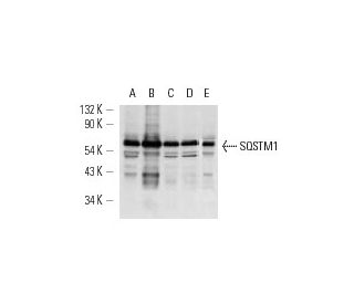 SQSTM1/p62 Antibody (formerly ZIP) - Western Blotting - Image 12723 