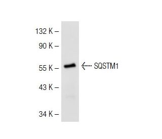 SQSTM1/p62 Antibody (A-6) | SCBT - Santa Cruz Biotechnology SQSTM1/p62 Antibody (A-6) | SCBT - Santa Cruz Biotechnology