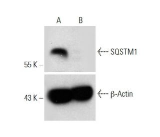 sqstm1-antibody-a-6-western- sqstm1-antibody-a-6-western-