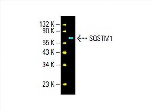 SQSTM1/p62 Antibody (A-6) | SCBT - Santa Cruz Biotechnology SQSTM1/p62 Antibody (A-6) | SCBT - Santa Cruz Biotechnology