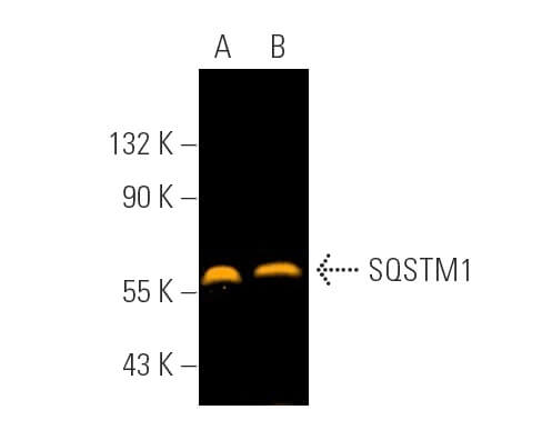 SQSTM1/p62抗体(D-3) | SCBT - Santa Cruz Biotechnology