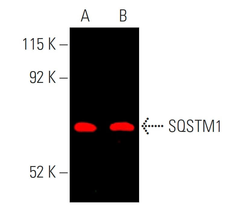 SQSTM1/p62抗体(D-3) | SCBT - Santa Cruz Biotechnology