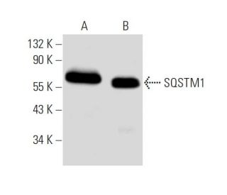 western blotting image from recommended SQSTM1/p62 (D-3) monoclonal antibody replacement. Image 8961