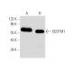 Dieser polyklonale Antikörper wird nicht mehr hergestellt. Wir empfehlen Ihnen unseren <a href="sqstm1-antibody-d-3">SQSTM1/p62 (D-3)</a> monoklonalen Antikörper (Beispielsdaten werden angezeigt). western blotting image from recommended SQSTM1/p62 (D-3) monoclonal antibody replacement. Image 8961