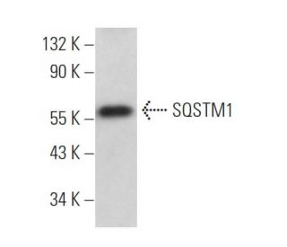 SQSTM1/p62 Antibody (D-3) - Western Blotting - Image 365957