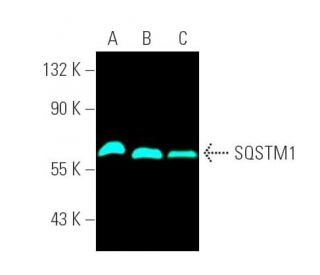 SQSTM1/p62 Antibody (D-3) - Western Blotting - Image 391497