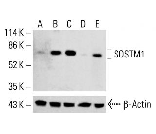 SQSTM1/p62 Antibody (D-3) - Western Blotting - Image 413022