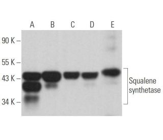 Squalene synthetase Antibody (A-7) - Western Blotting - Image 365144 