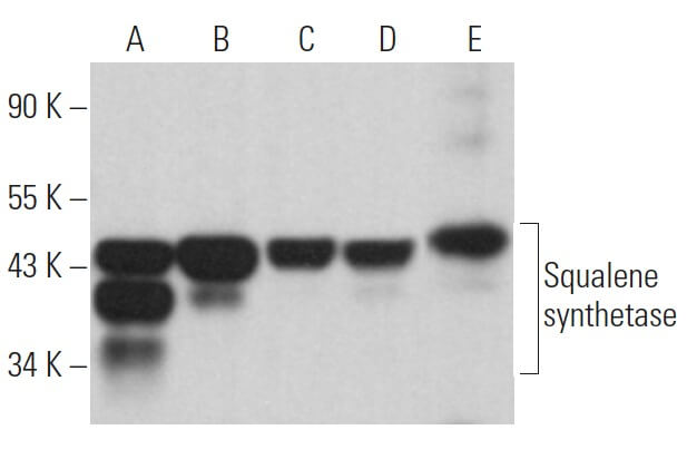 Squalene synthetase Antibody (A-7) | SCBT - Santa Cruz
